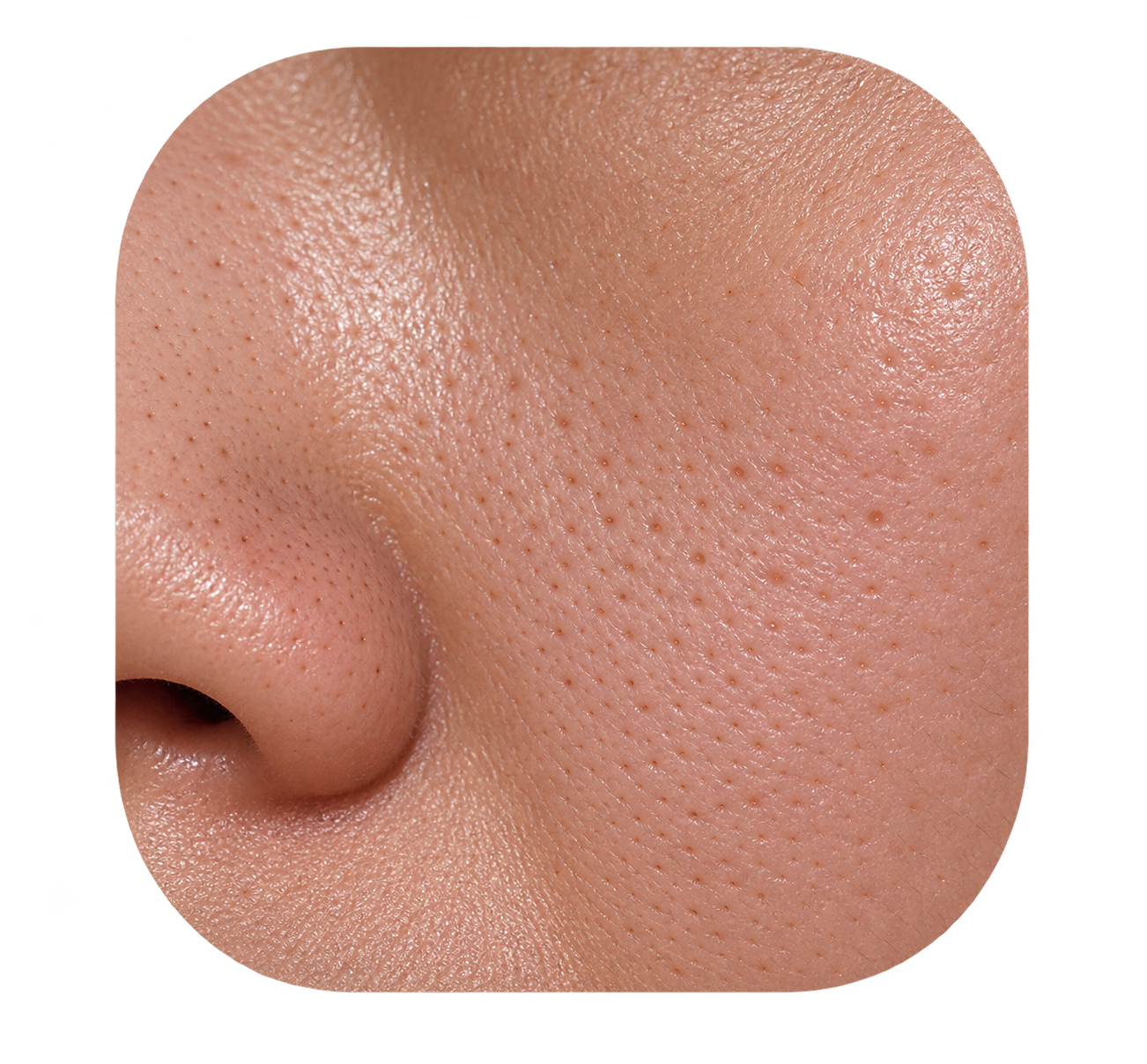 Visible pores