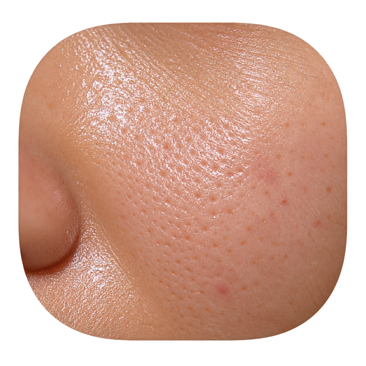 Oily skin