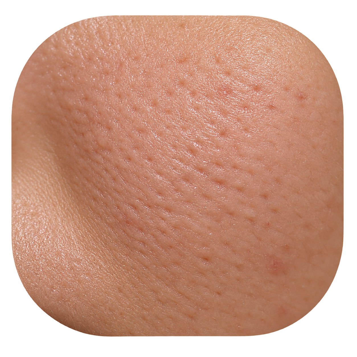 Rough skin