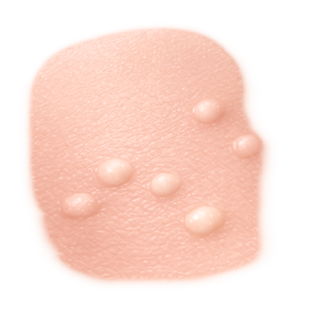 White or flesh-colored