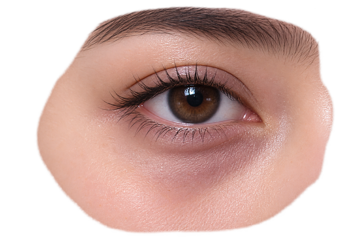 Illustration of the under-eye area