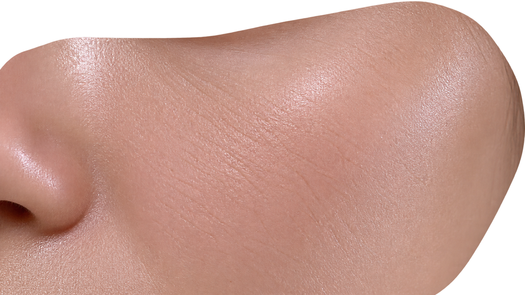 Dehydrated skin