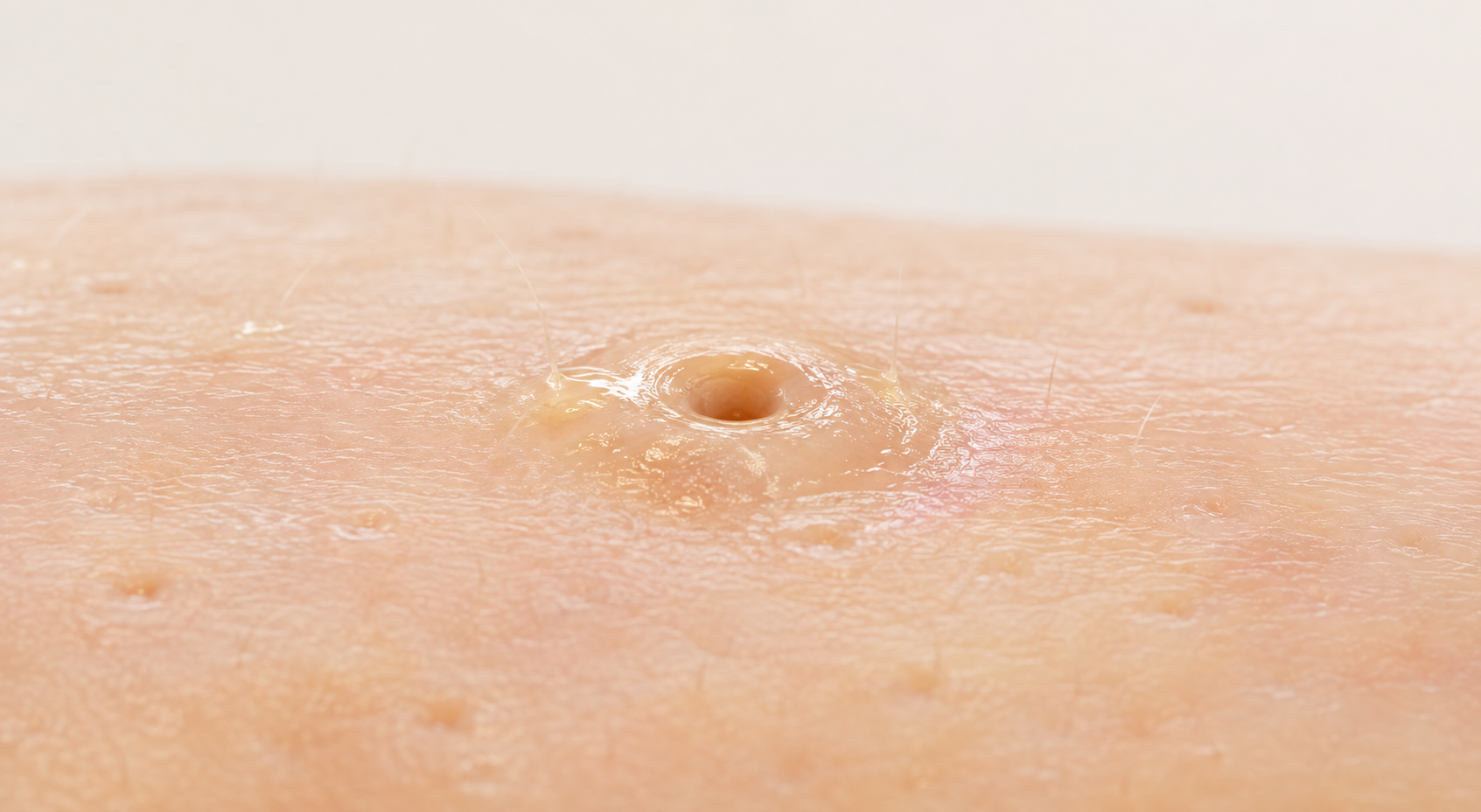Oil accumulating around a pore