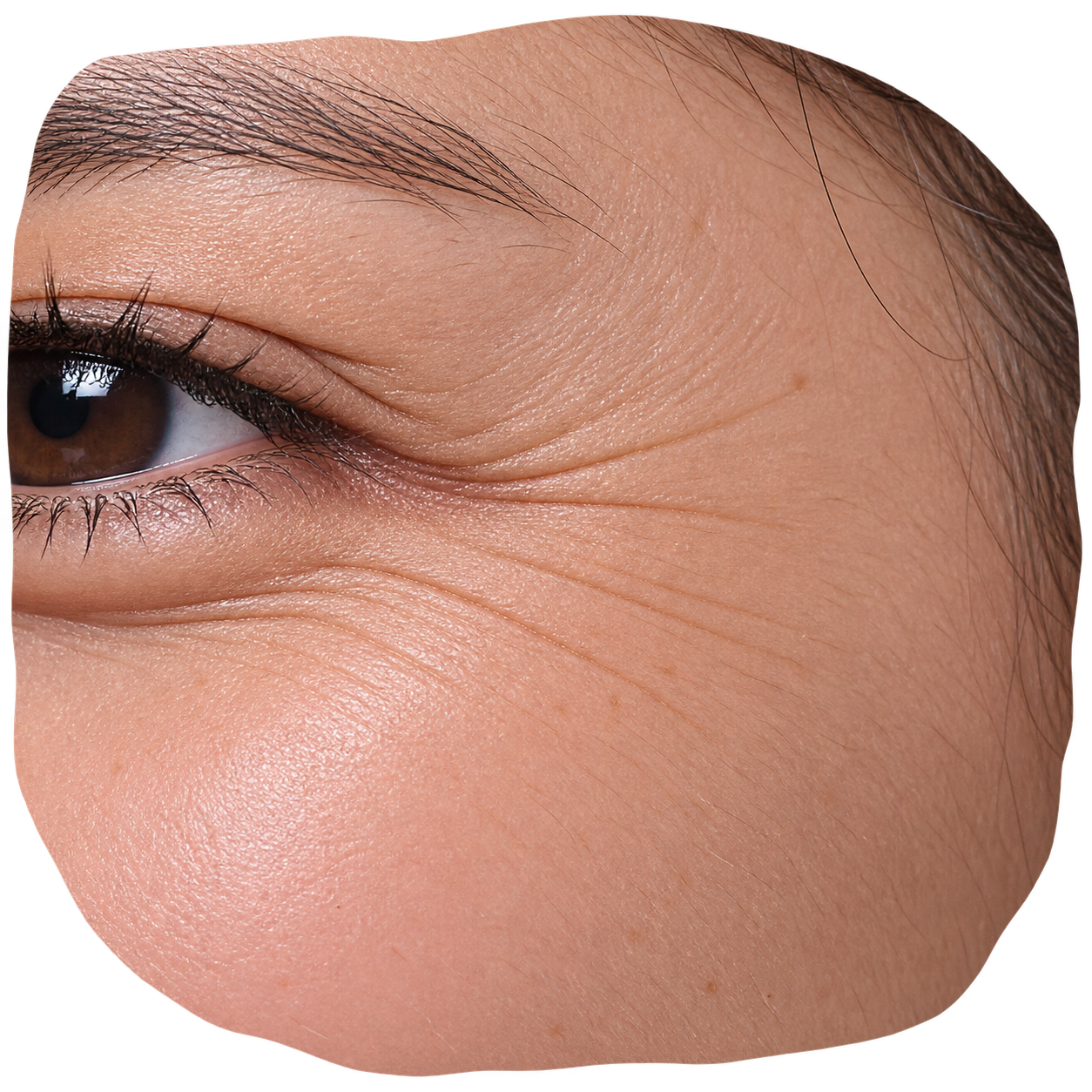 Wrinkles