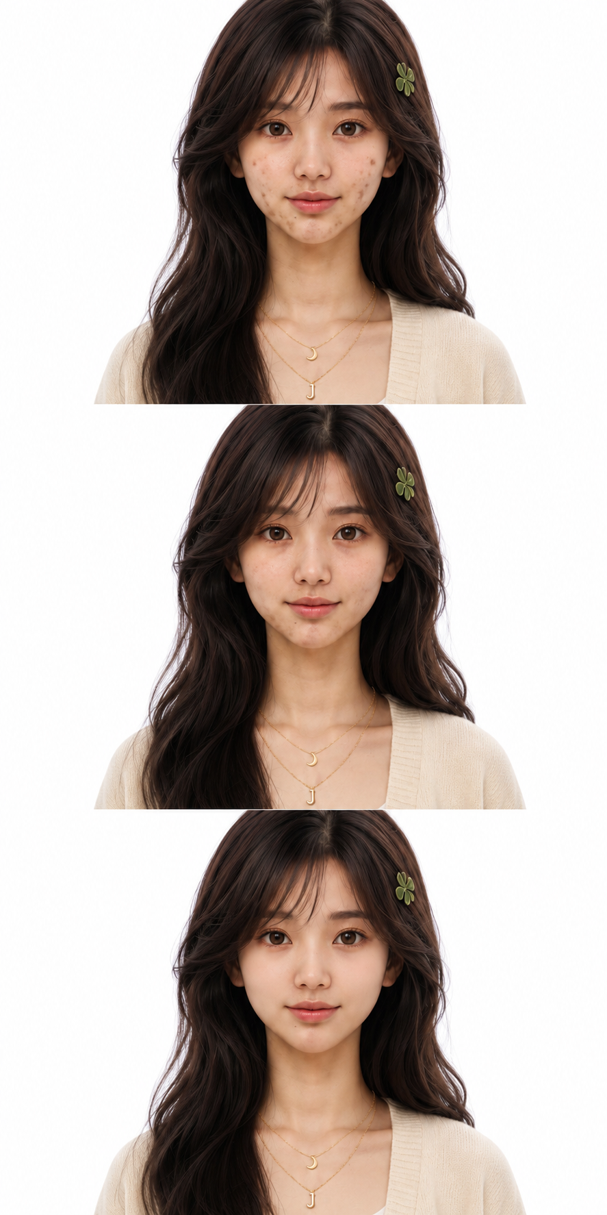 Hyperpigmentation fading over time
